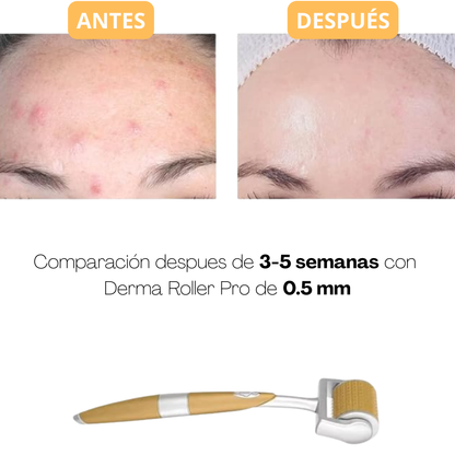 Derma Roller Pro